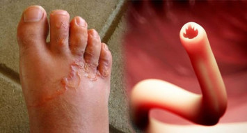 berjalan tanpa alas kaki