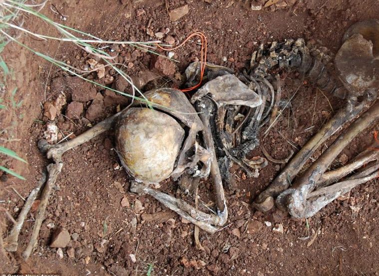 Body Farm
