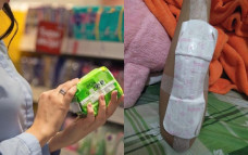 pembalut menutup luka