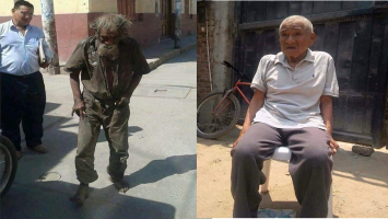 Perbedaan orang gila seyelah dirawat warga