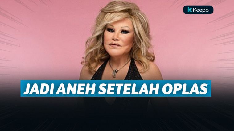 Seleb dunia bermuka aneh setelah oplas