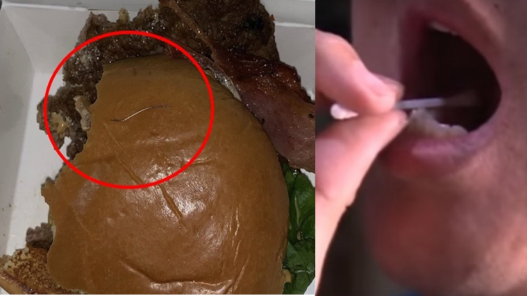 Ada jarum dalam burger