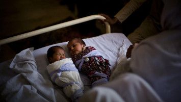 Bayi Kembar dengan Ayah yang Berbeda