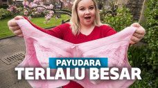 Punya Payudara Terlalu Besar, Perempuan Ini Galang Dana untuk Mengecilkannya
