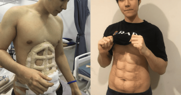 six-pack