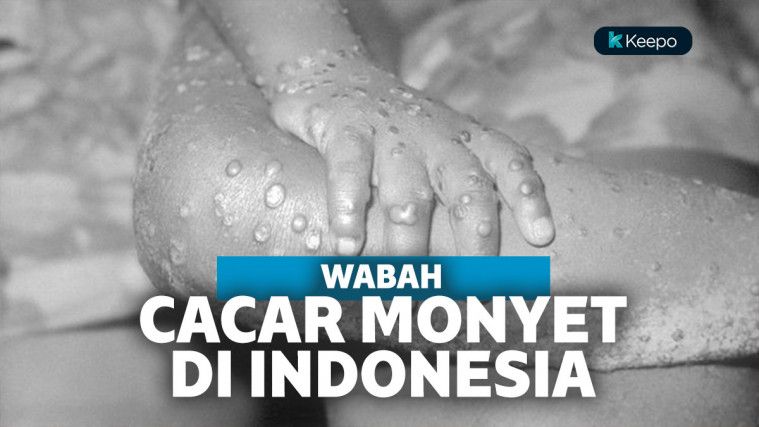 Waspada Cacar Monyet, Dinas Kesehatan Jaga Ketat Bandara