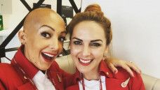 Tetap Pede Dengan Rambut Botak