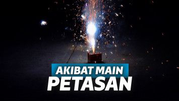 Main Petasan Jelang Berbuka, Bocah Ini Harus Rela Kehilangan Lima Jari Tangannya