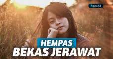 menghilangkan bekas jerawat