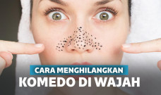 cara menghilangkan komedo
