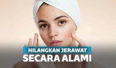 cara menghilangkan jerawat