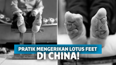 Lotus Feet, Praktik Ikat Telapak Kaki Wanita dari China