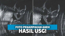 Ngeri! Inilah 4 Foto Seram Hasil USG Ketika Hamil!