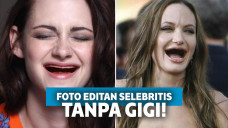 foto editan seleb tanpa gigi