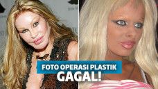 Operasi plastik gagal