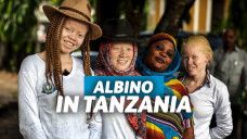orang albino di tanzania