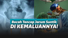 Menusukkan jarum ke penis