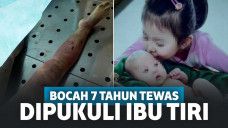 Dipukuli dengan Batang Besi, Bocah 7 Tahun Meregang Nyawa di Tangan Ibu Tirinya