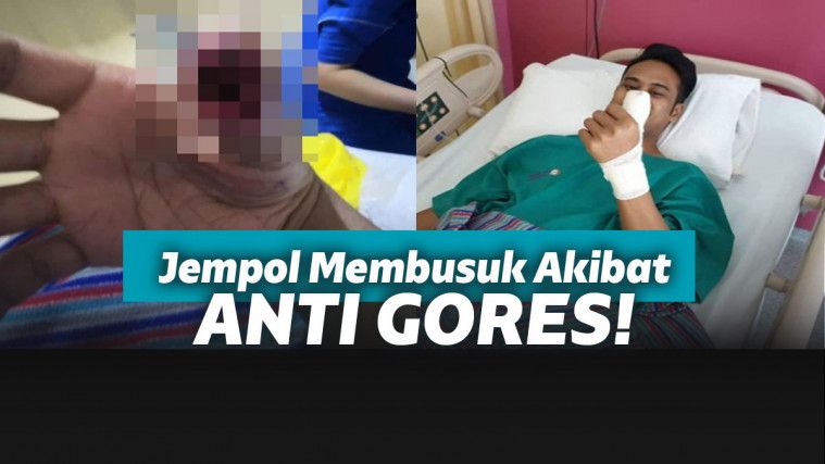 Gamer mengalami infeksi karena antigores