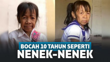 gadis usia 10 tahun yang terlihat seperti nenek-nenek