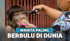 wanita berbulu