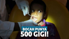 Ravindra yang sedang diperiksa karena sakit gigi yang sering dikeluhkannya