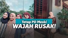 Tetap percaya diri