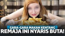 Gara-Gara Kebanyakan Makan Kentang, Remaja Ini Nyaris Buta