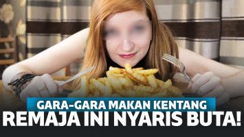Gara-Gara Kebanyakan Makan Kentang, Remaja Ini Nyaris Buta