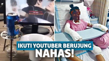 Ikuti Tutorial Masak YouTuber, Gadis Ini Alami Hal Mengerikan hingga Hampir Tewas