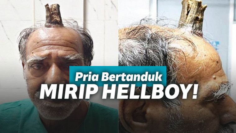 Tanduk tumbuh di kepala