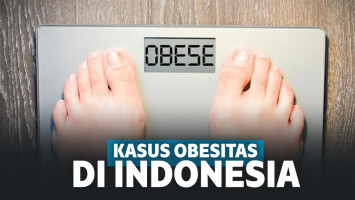 Ilustrasi obesitas