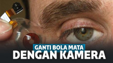 Ganti bola mata dengan kamera