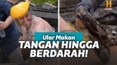 Pria yang lengannya digigit ular piton