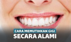 Cara memutihkan gigi