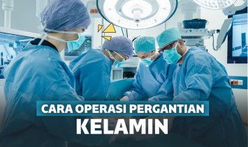 Operasi pergantian kelamin