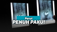 Paku di dalam perut