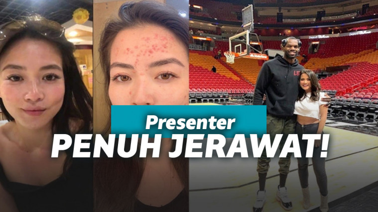Presenter TV jerawatan