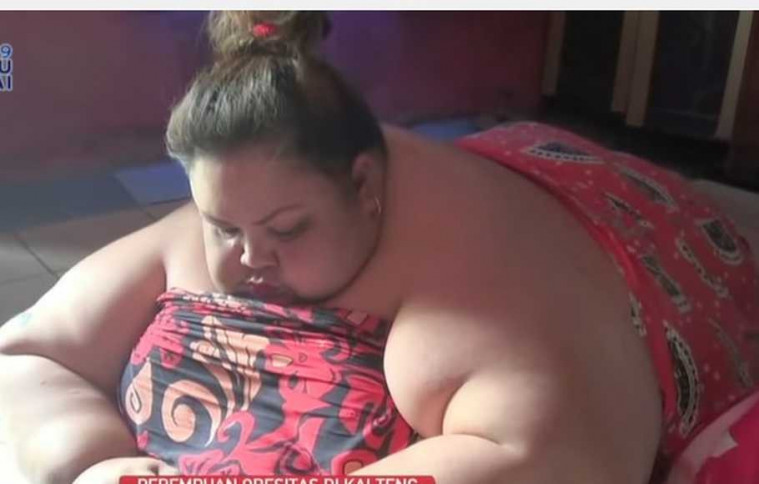 Titi Wati Obesitas