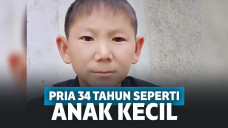 Zhu-Sengkai, pria dari Cina yang mengalami stagnansi pada pertumbuhan fisiknya.