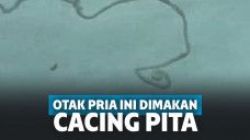 Ngeri! Dikira Kena Tumor Ganas, Ternyata Otak Pria Ini Digerogoti Cacing Pita Sepanjang 12 Cm