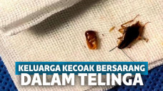 Ngeri! Merasa Ada yang Aneh, Pria Ini Kaget dalam Telinganya Ditemukan Keluarga Kecoak