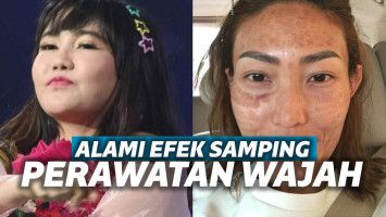 Via Vallen dan Ayu Dewi