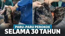 Paru-paru hitam pekat