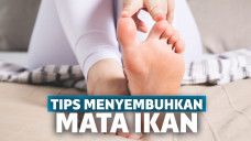 penyebab mata ikan