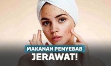 makanan penyebab jerawat