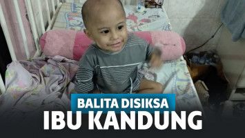 Ibu Siksa Anak Balitanya hingga Patah Kaki, Alasannya Wajahnya Mirip Mantan Suami