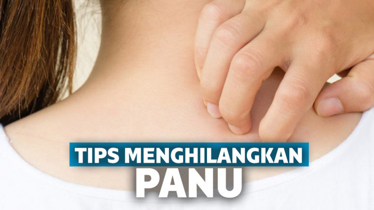 6 Cara Menghilangkan Panu Cepat Dan Ampuh