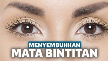 cara mengobati mata bintitan
