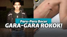 Dada dilubangi karena merokok